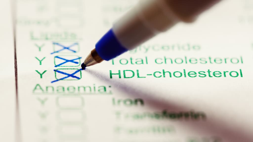 5 stappen om snel en veilig een hoog cholesterol te verlagen